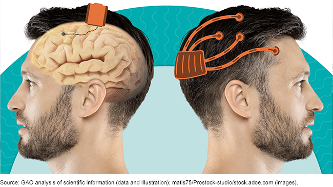 Illustration of a brain-computer interface on a person's head